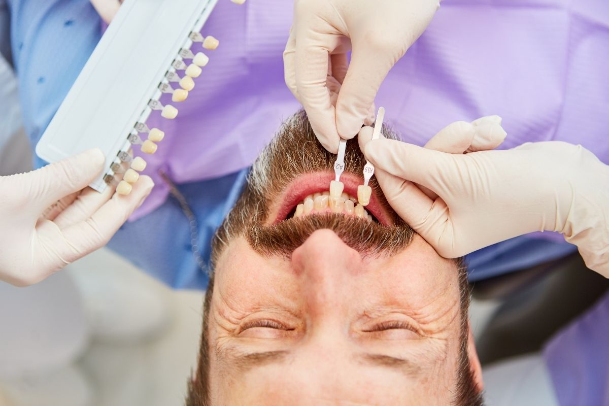 How Long Do Veneers Last Ellen Stirling Dental Ellenbrook