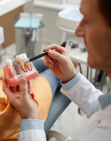 dental implants esd